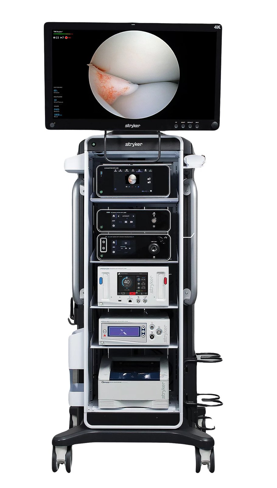 Endoscopy tower with monitor